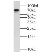 WB analysis of Y79 cells, using NUAK2 antibody (1/400 dilution).