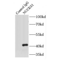 Nuclear Casein Kinase And Cyclin Dependent Kinase Substrate 1 (NUCKS1) Antibody