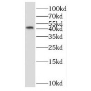 WB analysis of SGC-7901 cells, using NUCKS1 antibody (1/400 dilution).