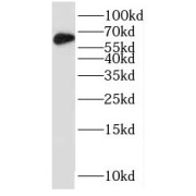 WB analysis of MCF7 cells, using nucleobindin 1 antibody (1/1000 dilution).