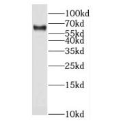 WB analysis of MCF7 cells, using NUCB1 antibody (1/1000 dilution).