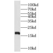 WB analysis of human brain tissue, using NUDCD2 antibody (1/500 dilution).