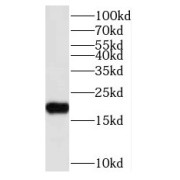 WB analysis of mouse brain tissue, using NUDT11 antibody (1/800 dilution).