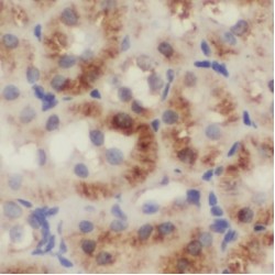 Nucleoside Diphosphate-Linked Moiety X Motif 19, Mitochondrial (NUDT19) Antibody