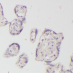 Cleavage And Polyadenylation Specificity Factor Subunit 5 (NUDT21) Antibody