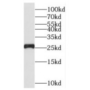 WB analysis of human brain tissue, using NUDT21 antibody (1/500 dilution).