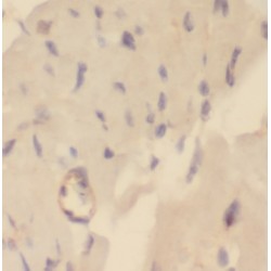 ADP-Ribose Pyrophosphatase, Mitochondrial (NUDT9) Antibody