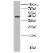 WB analysis of mouse brain tissue, using NUDT9 antibody (1/1000 dilution).