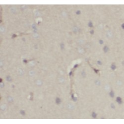 NUMB, Endocytic Adaptor Protein (NUMB) Antibody