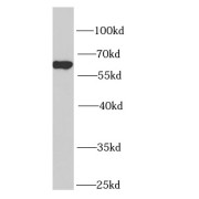 WB analysis of HeLa cells, using NUP62 antibody (1/1000 dilution).