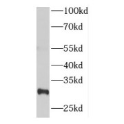 WB analysis of HeLa cells, using NUP62CL antibody (1/600 dilution).