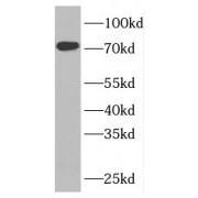 WB analysis of mouse lung tissue, using NUP85 antibody (1/400 dilution).