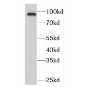 WB analysis of mouse testis tissue, using NUP93 antibody (1/1000 dilution).