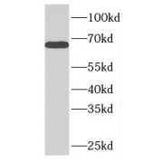 WB analysis of HepG2 cells, using NUPL1 antibody (1/500 dilution).