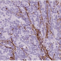 Nucleolar And Spindle-Associated Protein 1 (NUSAP1) Antibody