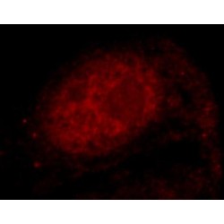 Nuclear RNA Export Factor 1 (NXF1) Antibody