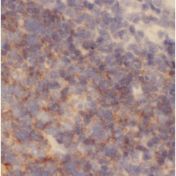 Nuclear RNA Export Factor 2 (NXF2) Antibody