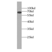 WB analysis of PC-3 cells, using OATP14 antibody (1/1000 dilution).