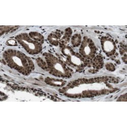 Outer Dense Fiber of Sperm Tails 3 (ODF3) Antibody