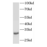 WB analysis of rat testis tissue, using ODF3 antibody (1/600 dilution).