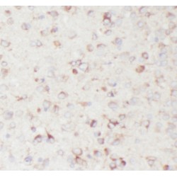 OFD1, Centriole And Centriolar Satellite Protein (OFD1) Antibody