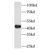 WB analysis of HeLa cells, using OFD1 antibody (1/500 dilution).