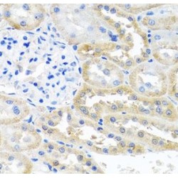 Opioid Growth Factor Receptor (OGFR) Antibody