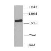 WB analysis of COLO 320 cells, using OGFR antibody (1/1000 dilution).