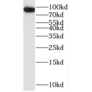 WB analysis of human brain tissue, using Oligophrenin 1 antibody (1/800 dilution).