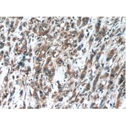 Oligophrenin 1 (OPHN1) Antibody