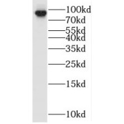 WB analysis of human brain tissue, using OPHN1 antibody (1/800 dilution).