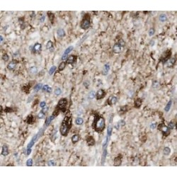 Optineurin (OPTN) Antibody