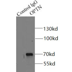 Optineurin (OPTN) Antibody