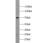 WB analysis of HeLa cells, using OPTN antibody (1/1000 dilution).