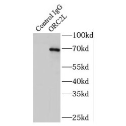 Origin Recognition Complex Subunit 2 (ORC2L) Antibody