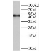 WB analysis of HeLa cells, using ORC4L antibody (1/500 dilution).