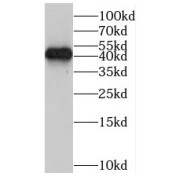 WB analysis of mouse liver tissue, using ORM1 antibody (1/1000 dilution).