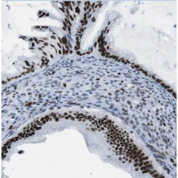 Oxysterol Binding Protein 1 (OSBP) Antibody