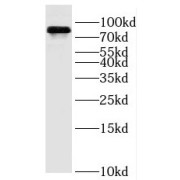 WB analysis of human skeletal muscle tissue, using OSBPL11 antibody (1/500 dilution).