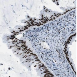 Oxysterol Binding Protein Like 2 (OSBPL2) Antibody