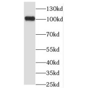 WB analysis of Y79 cells, using OSBPL3 antibody (1/400 dilution).