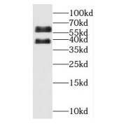 WB analysis of mouse ovary tissue, using OSGIN1 antibody (1/1000 dilution).