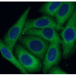 Osteopontin (SPP1) Antibody