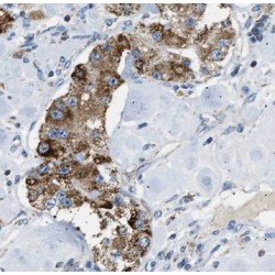 Osteopontin (SPP1) Antibody