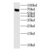 WB analysis of mouse kidney tissue, using Osteopontin antibody (1/600 dilution).