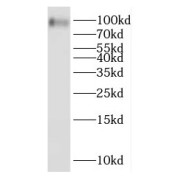 WB analysis of MCF7 cells, using OTOP3 antibody (1/500 dilution).