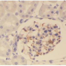 OTU Deubiquitinase 4 (OTUD4) Antibody