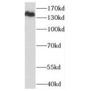 WB analysis of HeLa cells, using OTUD4 antibody (1/1000 dilution).