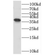 WB analysis of PC-3 cells, using OTUD6B antibody (1/600 dilution).