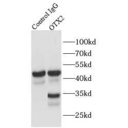 Homeobox Protein OTX2 (OTX2) Antibody